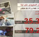 78 شهيدا وجريحا في جرائم صهيونية جديدة بغزة