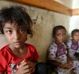 الامم المتحدة :تدعو لمساعدة أكثر من 80% من سكان اليمن 