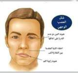   العصب السابع اسبابه وطرق علاجه