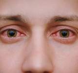 علامات في العين تحدد مشاكلك الصحية