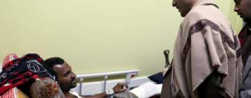 وزير الخدمة المدنية يتفقد الجرحى بمستشفى الثورة في إب