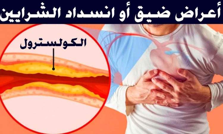 أعراض انسداد الشرايين وأسبابه   