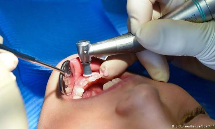 (الأسنان الطباشيرية) مرض يصيب الأطفال ويحير الأطباء