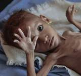 الصليب الأحمر:الهدنة لم تحسن الظروف الإنسانية في اليمن
