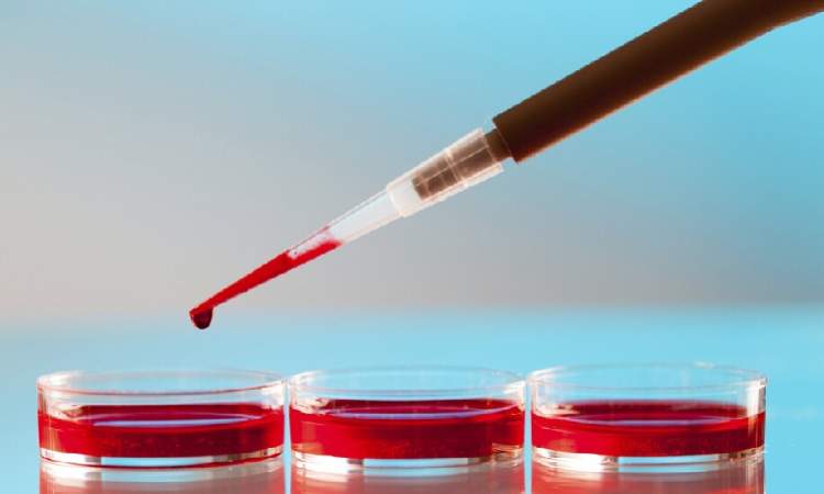 لاول مرة في العالم : نقل خلايا دم حمراء نمت في المختبر إلى مريضين 