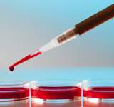 لاول مرة في العالم : نقل خلايا دم حمراء نمت في المختبر إلى مريضين 