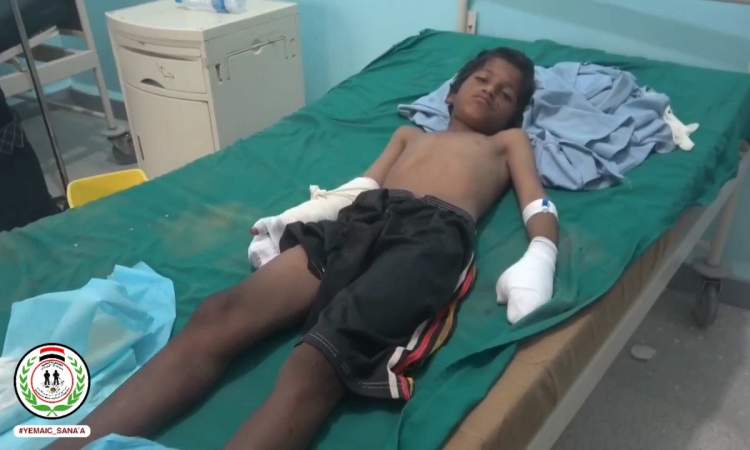 اصابة طفل بانفجار قنبلة عنقودية في الجوف