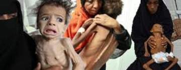 شبكة دولية تحذر من انهيار غذائي حاد في اليمن جراء العدوان والحصار