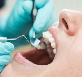 اخصائية طب اسنان توضح اسباب إلتهابات اللثة