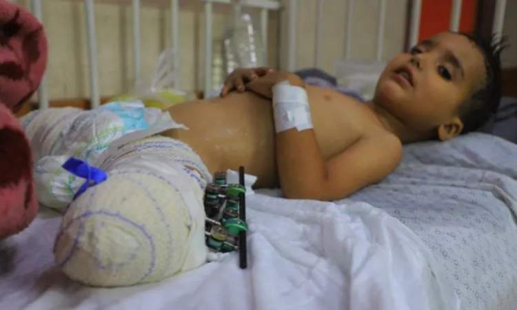 أيتام غزة : حكايات أطفال فقدوا الأب والأم في الحرب