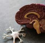 علاج مطور يقضي على ورم الدماغ الخبيث القاتل في أيام