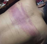 أحد وجهاء الصبيحة يتعرض للاختطاف والتعذيب في عدن